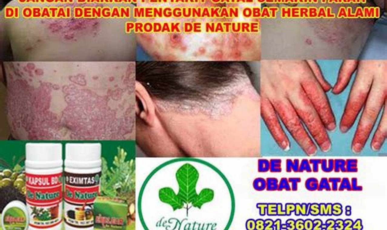 Cara Mengatasi Gatal Gatal
